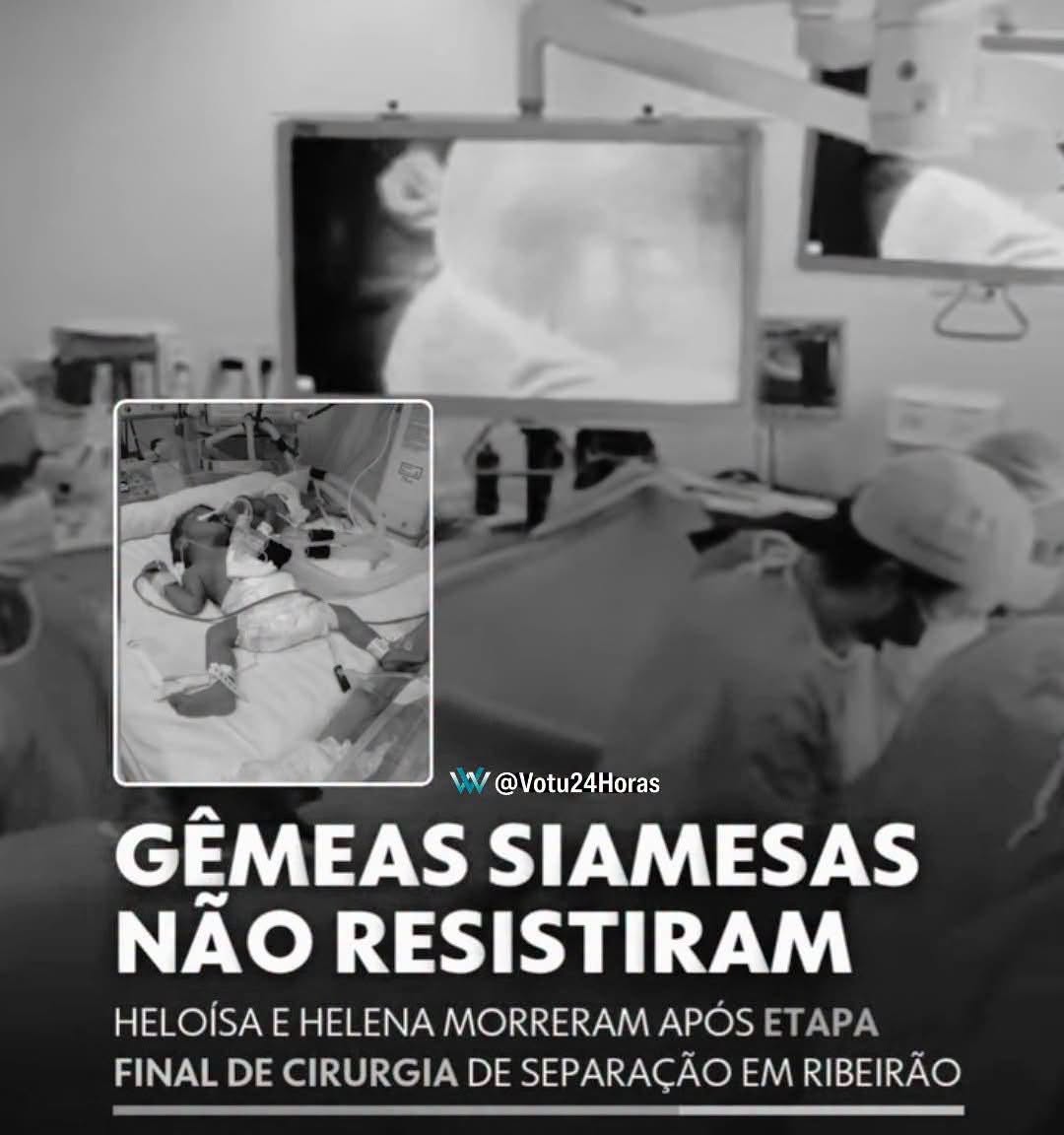 GÊMEAS SIAMESAS MORREM APÓS CIRURGIA DE SEPARAÇÃO
